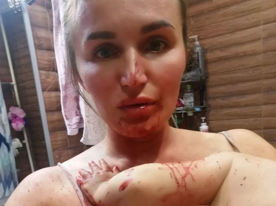 Избитая жена владельца магазина "Мореход" в Красноярске заявила об угрозах от экстремистов