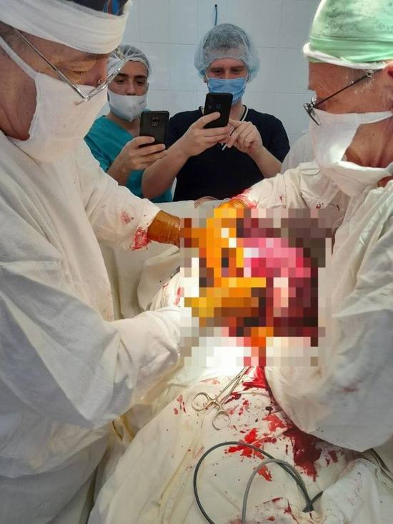 Медики из Балаково удалили 20-килограммовую опухоль у пациента