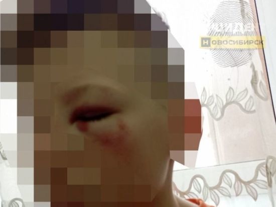 В Новосибирске СК начал проверку избиения прохожим 13-летнего мальчика