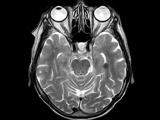 Сафоновец дал прикурить, и получил за это доской по голове