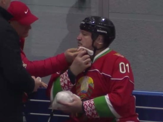 Лукашенко получил клюшкой по лицу во время хоккейного матча
