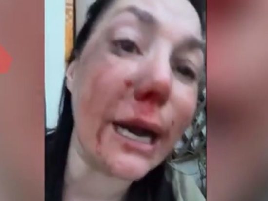 Звезда "Бумера" Дарья Мищенко обвинила украинцев в избиении в Италии