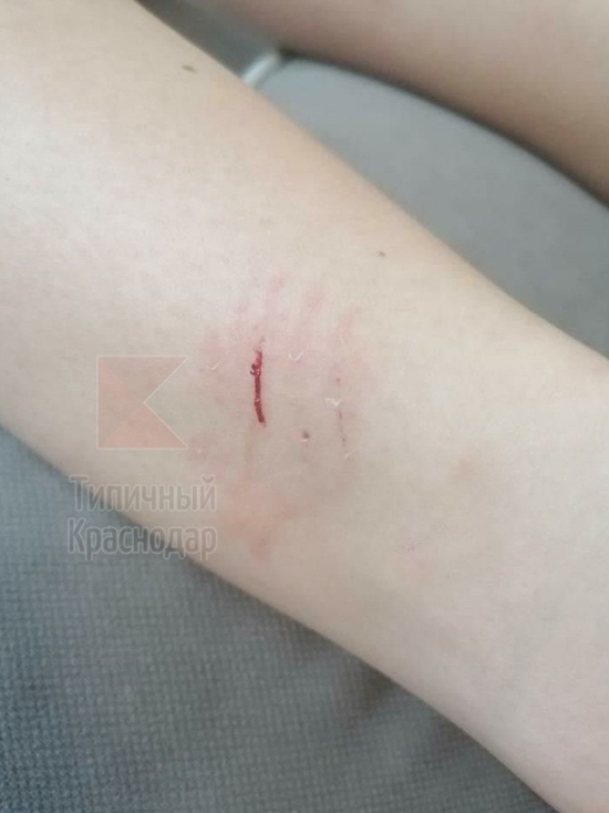 На набережной ЮМР в Краснодаре собака укусила подростка на велике