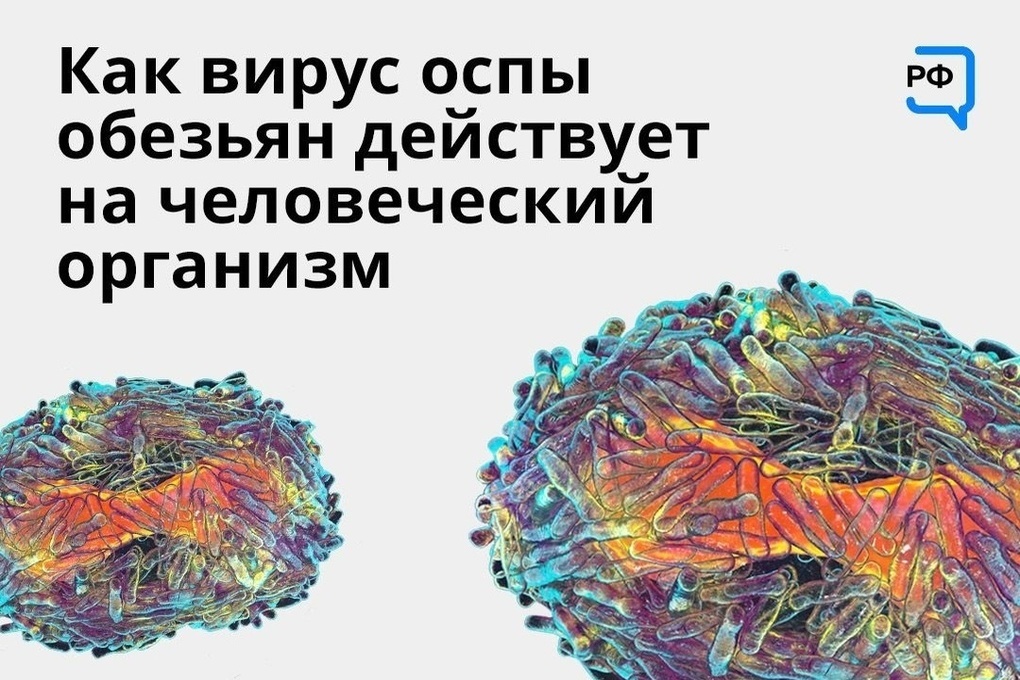 Оспа обезьян как выглядит у человека Важную информацию об оспе обезьян довели до сведения жителей Серпухова - МК Серп