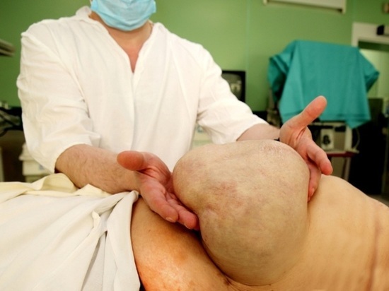 В Калуге врачи вырезали женщине гигантскую грыжу