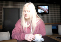 Представители животного мира, в том числе люди с альбинизмом, встречаются редко и всегда вызывают интерес, а иногда и отторжение в обществе
