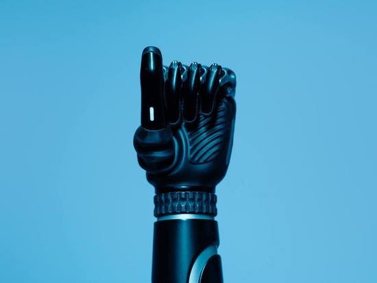 Житель Карелии стал обладателем бионической руки, напечатанной на 3D-принтере