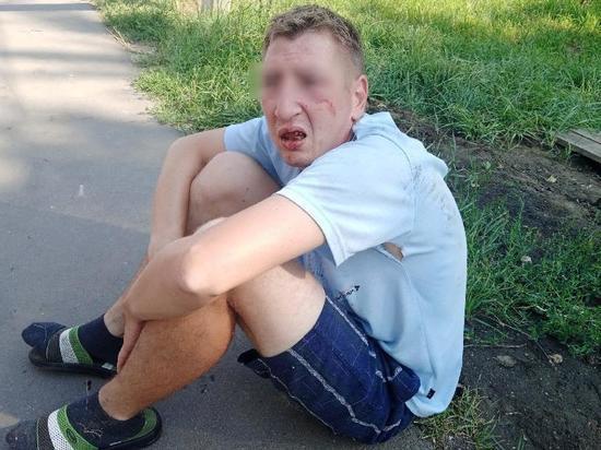В Ряжске трое подростков избили 35-летнего инвалида детства и его мать