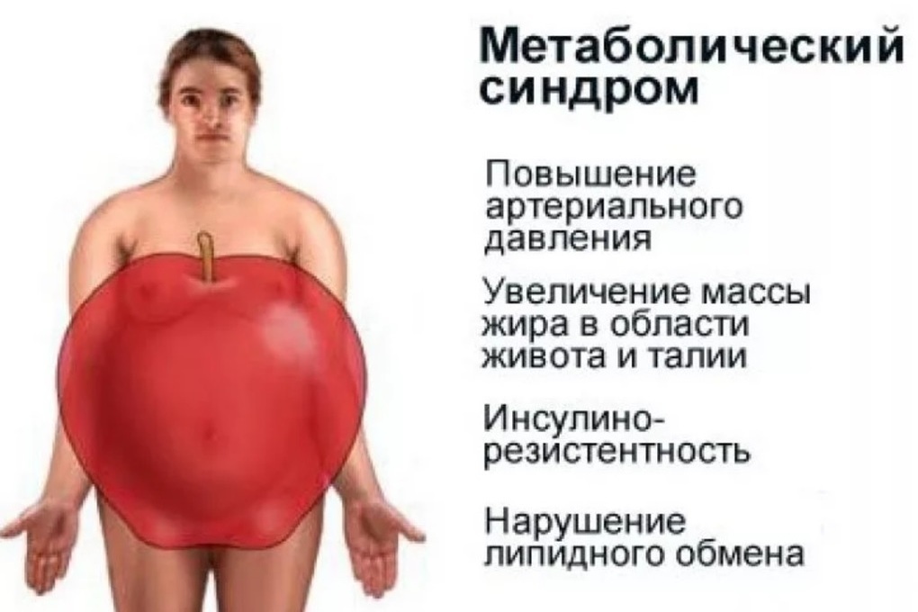 Лишний вес заболевания. Метаболический синдром. Нарушения обмена веществ – метаболический синдром;. Абдоминальное ожирение-метаболический синдром. Метаблдическийсиндром.