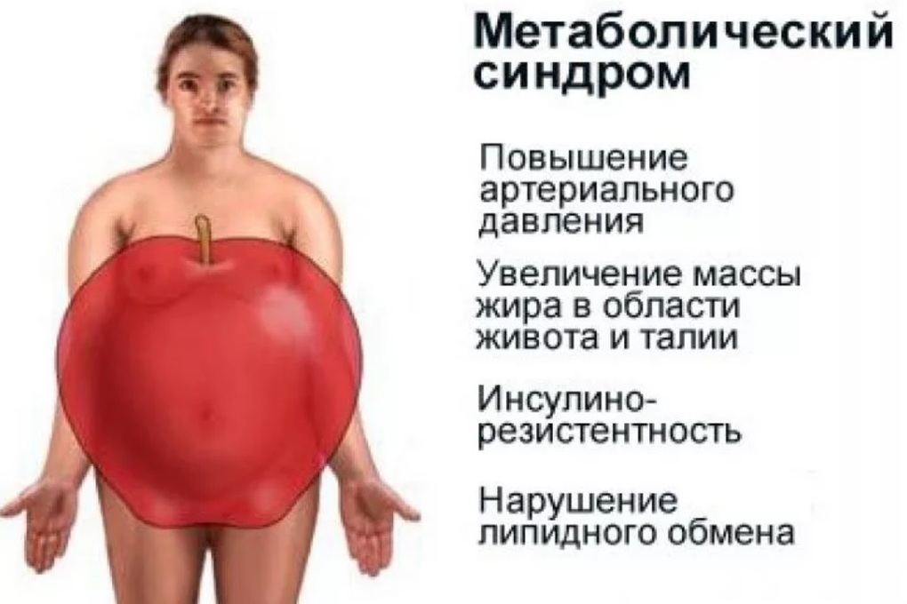 Живот При Инсулинорезистентности Фото