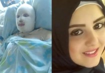 Ливанская женщина борется за свою жизнь после того, как ее поджег муж