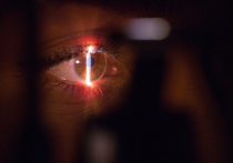 Проволоку из глаза пациента извлекли офтальмологи в одной из больниц Московской области