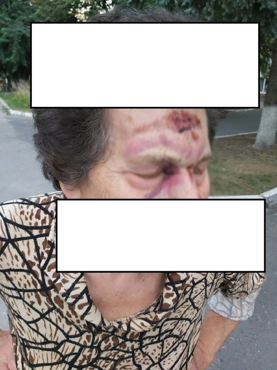 В Курске после падения из маршрутки пенсионерка попала в нейрохирургию