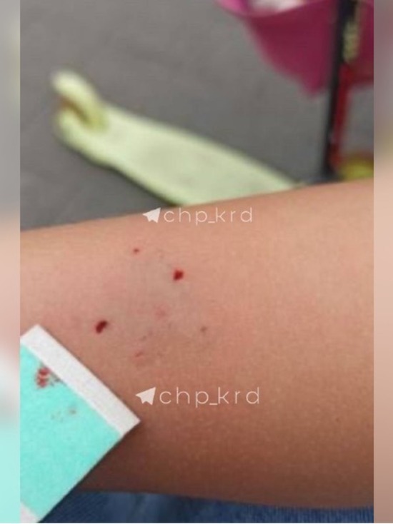 Соцсети: в сквере Дружбы в Краснодаре сурикат покусал ребёнка