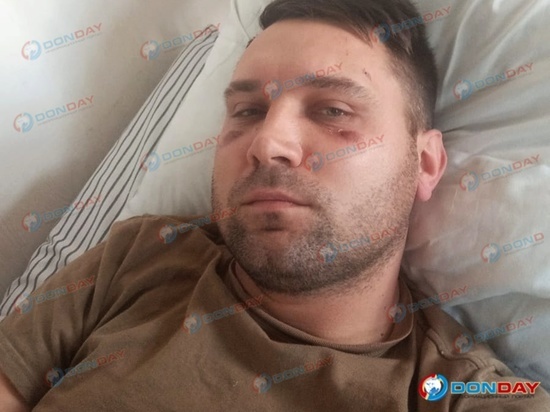 В Ростовской области под мобилизацию попал мужчина с кистой головного мозга