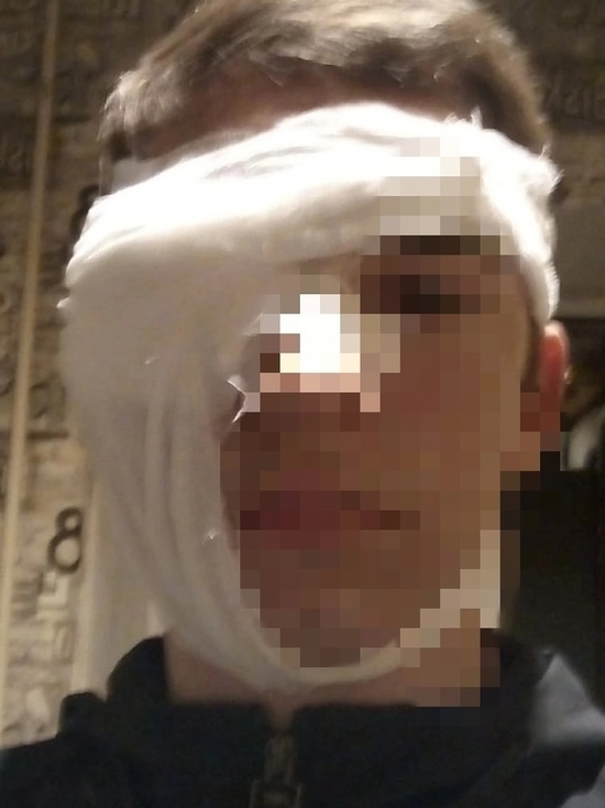 Порвал два века: в кузбасском городе ребенок травмировался на футбольном поле
