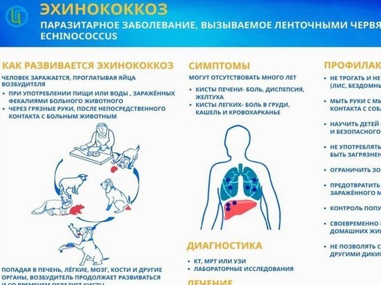 Шесть жителей Красноярского края заболели эхинококкозом в 2022 году