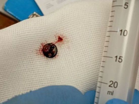 Ступинский врач вытащил из носа ребенка руль от игрушечного автомобиля