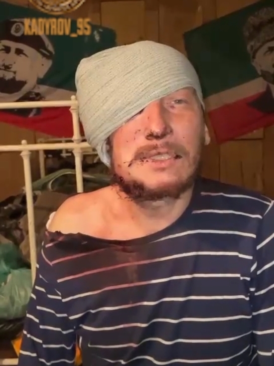 Кадыров показал пленного и обратился к СБУ: хлопаете глазами