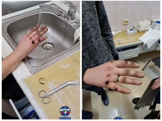 Подростку с обмороженными руками сняли кольцо с пальца спасатели в Новосибирске