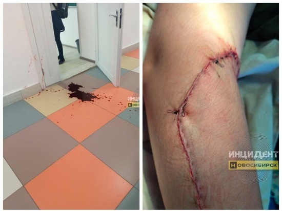В школе в Новосибирской области 11-летнему ребенку разорвало руку дверной ручкой