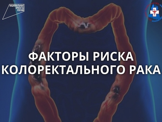 Жителей Ноябрьска приглашают проверить толстую кишку на наличие рака