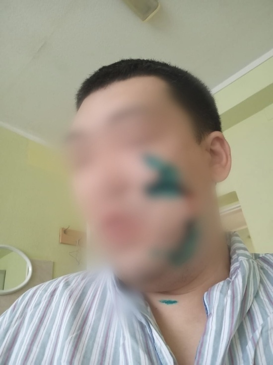 Астраханец порезал лицо оскорбившему его жену мужчине