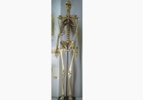 Британский музей уберет из экспозиции свой самый известный экспонат — скелет человека 18-го века, широко известного как «Ирландский великан»