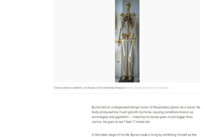 The skeleton of a man who was afraid to become a museum exhibit will finally be removed from the exhibition
