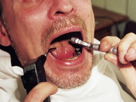 Стоматолог Бойцова заявила, что алкоголь разрушает зубы