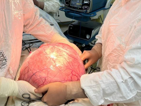Уникальная операция: омичке удалили 15-килограммовую опухоль