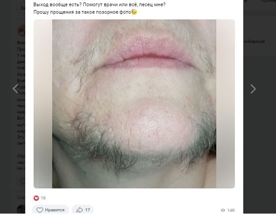 Фото В Новосибирске у 40-летней жительницы выросла борода 2