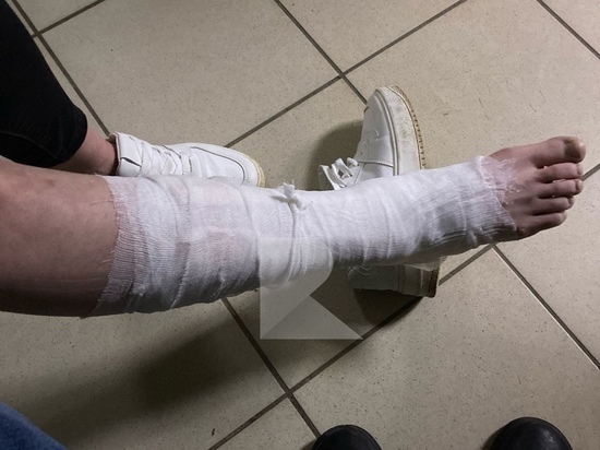 Жительница Рязани сломала ногу в нечищеном дворе на улице Дзержинского