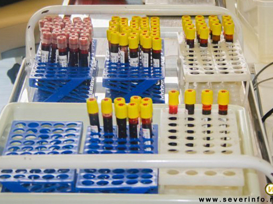 Кровь I и IV групп необходима медикам в Вологде