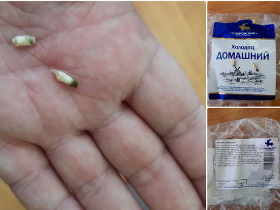 Жительница Воронежа обнаружила зубы в купленной в сетевом магазине пачке холодца