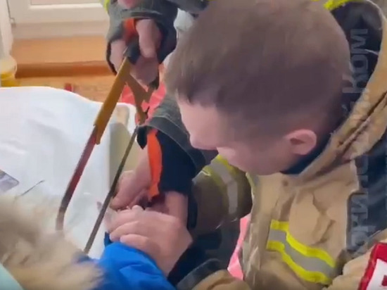 В Губкинском спасатели ножовкой снимали с пальца ребенка узкое кольцо