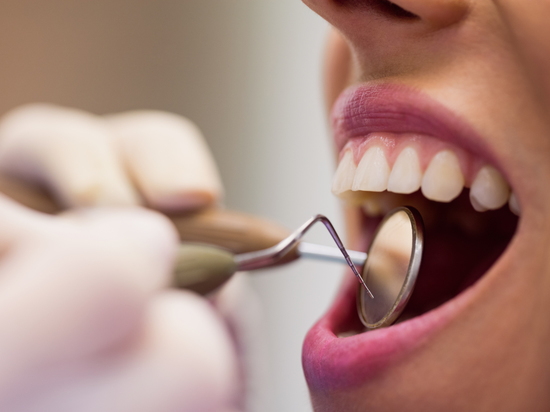 Стоматолог назвала причины изменения эмали зубов