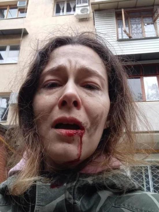 В Сочи пенсионер ударил палкой по лицу женщину, выгуливавшую собаку
