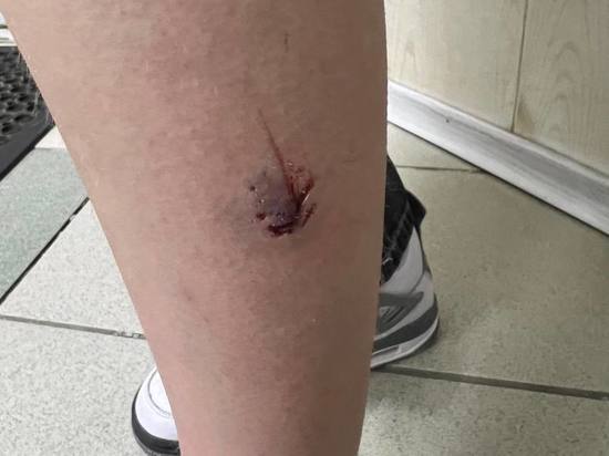 В Коротчаево бездомная собака укусила 13-летнюю девочку