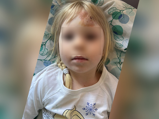 Лихач на электросамокате сбил в Москве четырехлетнюю малышку: перелом черепа