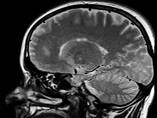Nature Neuroscience: нейросеть научилась читать мысли по данным МРТ