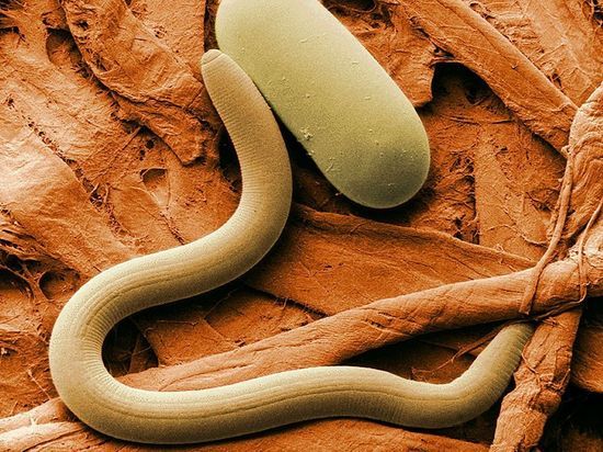 Aging Cell: в круглых червях обнаружены гены молодости