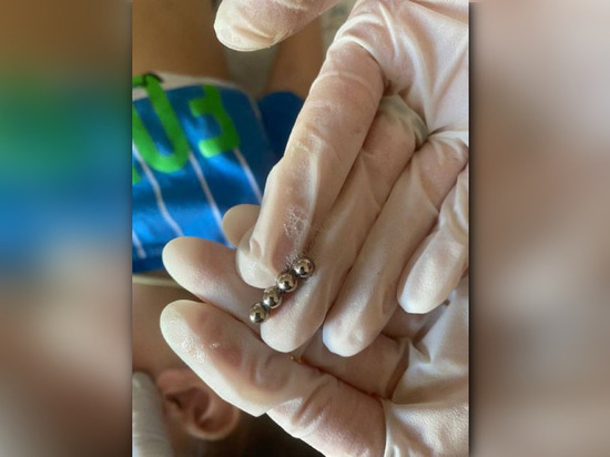 Уфимские хирурги извлекли из желудка четырехлетнего малыша магнитные шарики