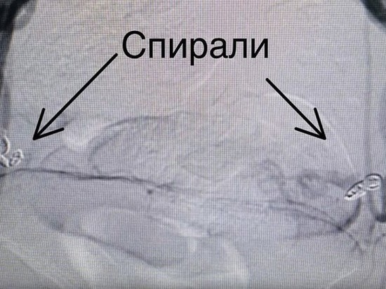 Хабаровские хирурги провели уникальную операцию 25-летней женщине