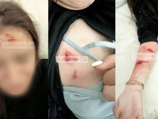 Полиция Краснодара проводит проверку после нападения овчарки на двух девушек