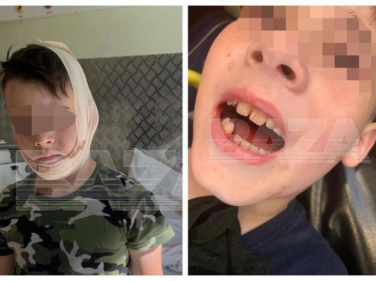 Отец сбитого 8-летнего мальчика заявил, что полицейский из Новосибирска был пьян
