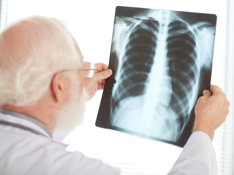 Жители Петрозаводска смогут проверить, нет ли у них рака легких