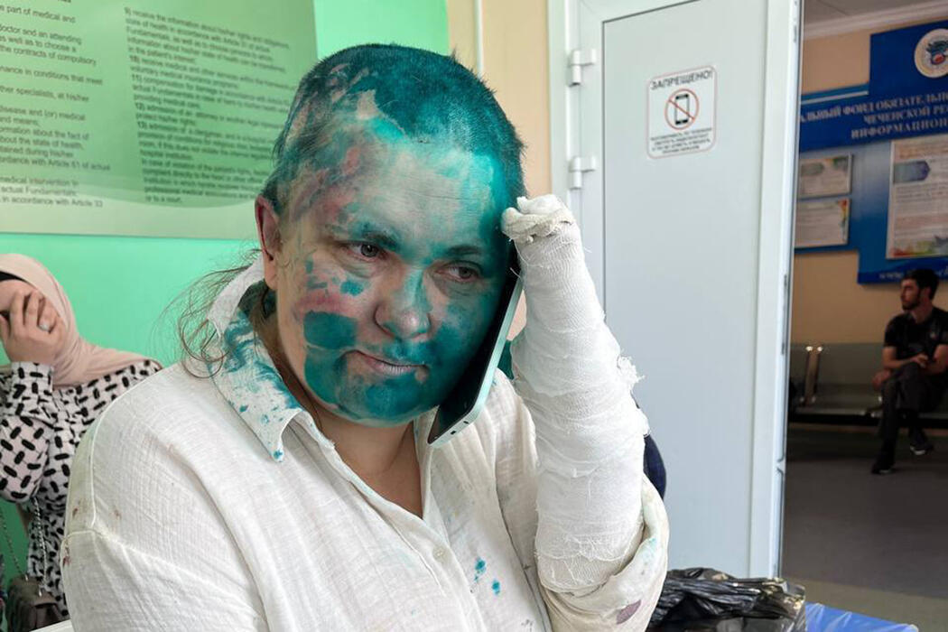 Журналистку Милашину и адвоката Немова жестоко избили в Чечне: фото из больницы