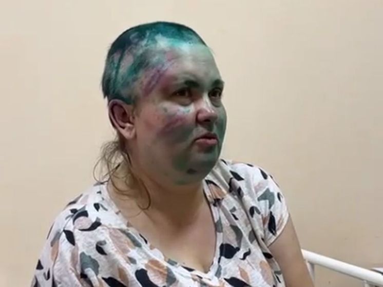 Журналистка Елена Милашина рассказала о своем состоянии после нападения