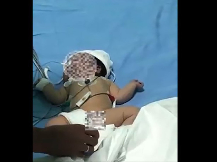 В Кыргызстане впервые провели операцию на сердце двухдневному младенцу